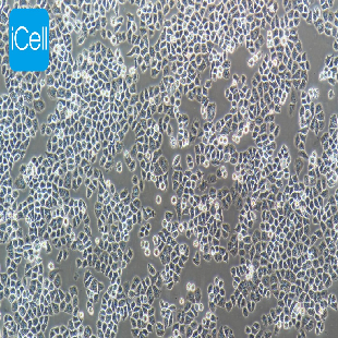 Human Normal Ovarian Epithelial Cell Line, #IOSE-80