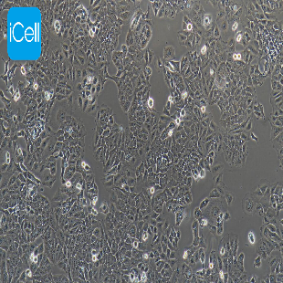 Human Endometrial Cancer Cell Line, #ISHIKAWA