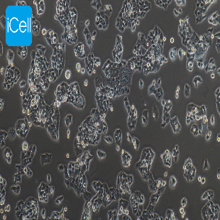 Human Lung Squamous Cancer Cell Line, #NCI-H520