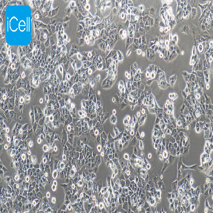 Human Highly Metastatic HCC Cell Line, #MHCC-97H