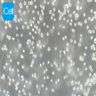Human Anterior B Acute Lymphoblastic Leukemia Cell Line, #NALM-6