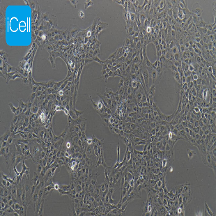 Human Hepatic Astrocytes, #LX-2