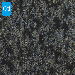 Human Colorectal Adenocarcinoma Cell Line, #LS174T