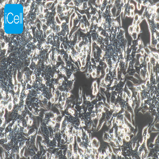 Human Colorectal Cancer Cell Line, #LOVO