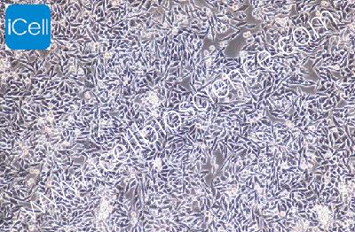Human Colorectal Cancer Cell Line, #P53R [JHU-56]