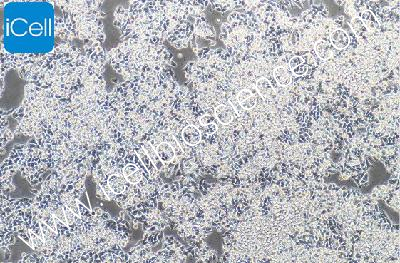Human Colon Cancer Cell Line, #CW-2