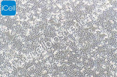 Colon Cancer Cell Line, #CX-1