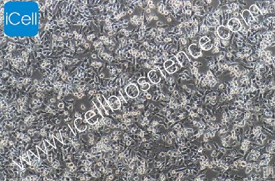 Human Pancreatic Cancer Cell Line, #PATU8988S