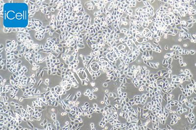 Human Lung Cancer Cell Line, #PC-9