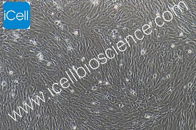 Human Dermal Fibroblasts (Immortalized In Primary Cell Line) , #HSF (SV40)