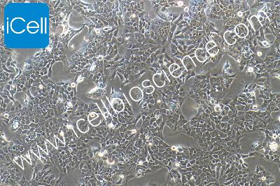 Colon Cancer Cell Line, #CX-1