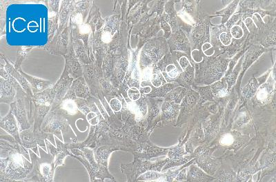 Immortalized Cell Line Of The Human Normal Prostate Stroma, #WPMY-1