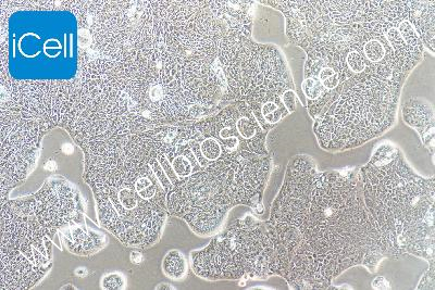 Human Colonic Adenocarcinoma Cell Line, #SW1116