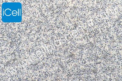Human Colorectal Adenocarcinoma Cell Line, #SW620