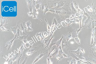 Human Thyroid Cancer Cell Line, #SW579