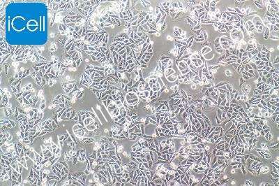 Human Colonic Adenocarcinoma Cell Line, #SW480