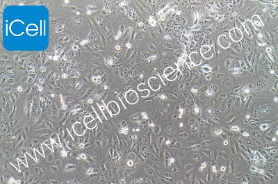 Immortalized Cell Line Of The Human Ureteric Epithelium, #SV-HUC-1