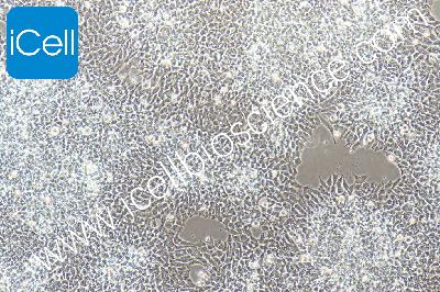 Human Neuroepithelioma Cell Line, #SK-N-MC