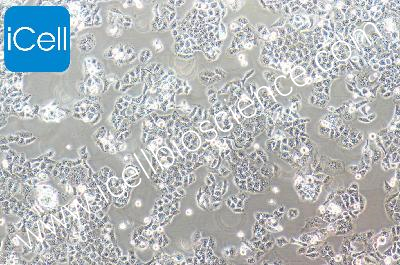 Human Small Cell Lung Cancer (Not Available) , #SBC-2