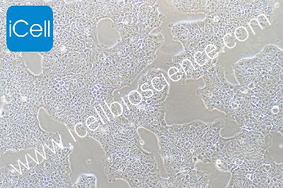 Migratory Cell Papilloma Of The Human Bladder, #RT4