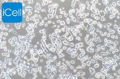 Human Endometrial Cancer Cell Line, #RL95-2