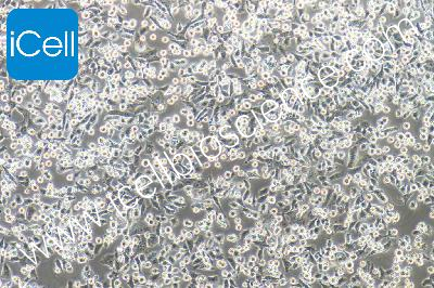 Human Pancreatic Cancer Cell Line, #PATU8988T