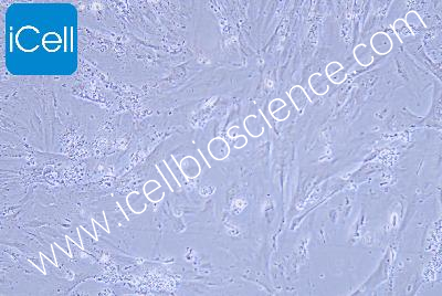 Human Normal Colonic Epithelial Cell Line (Limited Cell Line) , #CCD841 CON
