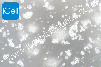 Human Colorectal Adenocarcinoma Cell Line, #COLO320 HSR
