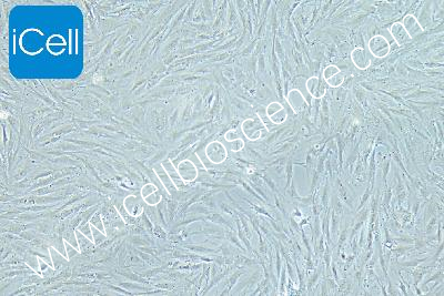 Granulosa Cell Tumour Cell Line Of The Human Ovary, #KGN