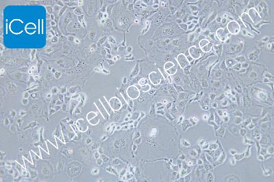 Human Endometrial Cancer Cell Line, #KLE