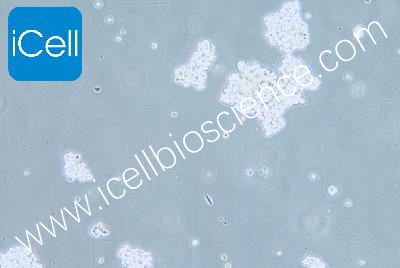 Human Non-Small-Cell Lung Cancer Cell Line, #NCI-H524