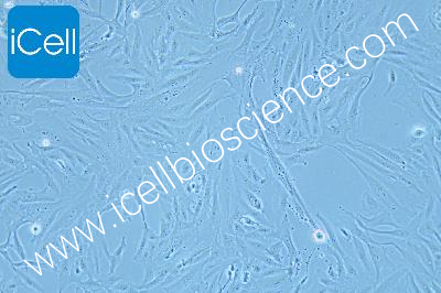 Human Adrenocortical Small Cell Carcinoma Cell Line, #SW1353