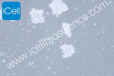 Human Small-Cell Lung Cancer Cell Line, #SHP-77