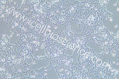 Human Embryonic Kidney Cells, high yield Lentiviral Packaging, #293FT