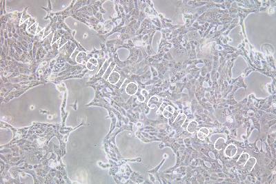 Human Pancreatic Cancer Cell Line, #CFPAC-1