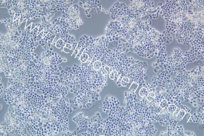 Granulosa Tumor Cell Line Of The Human Ovary, #COV434