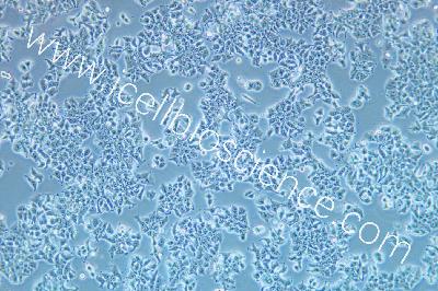Human Lung Cancer Cell Line, #DMS 53