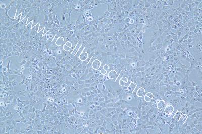 Human Chorionic Trophoblast Cell Line, #HTR-8/SVNEO