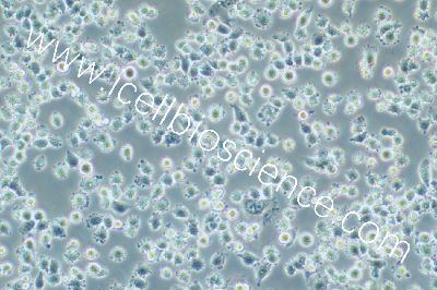 Human Papillary Thyroid Carcinoma Cell Line, #IHH4