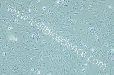 Human Thyroid Cancer Cell Line, #KTC-1