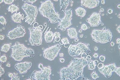 Human Classic Small-Cell Lung Cancer Cell Line, #NCI-H1688
