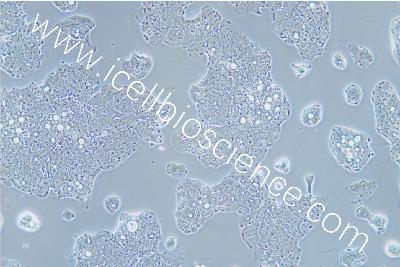 Human Colonic Adenocarcinoma Cell Line, #SW948