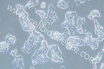 LUCiferase Labeling In Human Breast Cancer Cell Line, #ZR-75-1+LUC