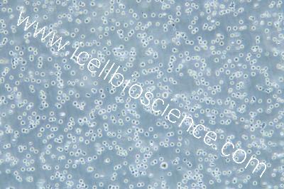 Human Acute Myeloid Leukemia Cell Line, #OCI-AML3