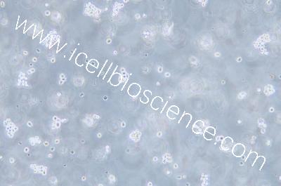 Human Acute Myeloid Leukemia Cell Line, #SKNO-1