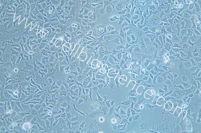 Human Small-Cell Lung Cancer Cell Line, #DMS 114