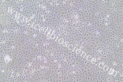 Human Thyroid Carcinoma Cell Line (Undifferentiated) , #ACT-1