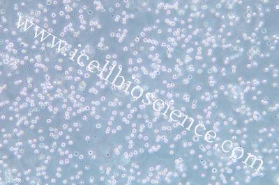 The EBV-Transformed Lymphoid Cell Line, #AKATA