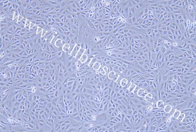 Human Endometrial Adenocarcinoma Cell Line, #AN3CA