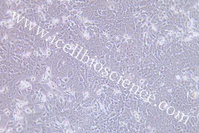 Human Thyroid Cancer Cell Line, #BHT101